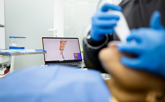 Taking digital impression of patient's teeth